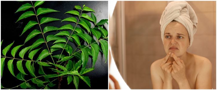 11 Manfaat daun neem untuk kecantikan, wajah bebas jerawat