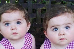 7 Foto gemes Niamh dan Esme, selebgram kembar yang imutnya kebangetan