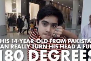 Sameer Khan, anak 14 tahun yang bisa putar kepalanya 180 derajat