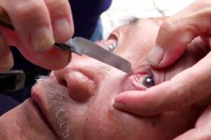 Pria China ini tawarkan jasa membersihkan bola mata dengan pisau cukur