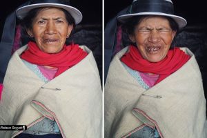 10 Foto before vs after sosok nenek tersenyum, bikin mood-mu bagus deh