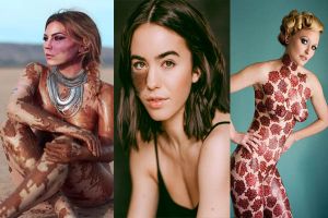 Punya kelainan kulit, 7 wanita ini sukses menjadi model populer