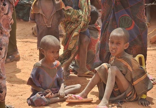 Hari Pangan Sedunia, 5 negara 'paling lapar' ini perlu perhatian dunia