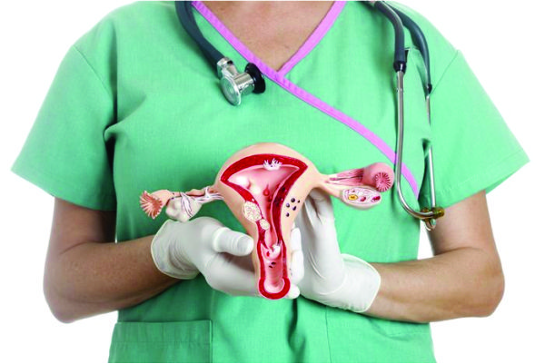 4 Terapi hormon untuk mengatasi mioma uteri