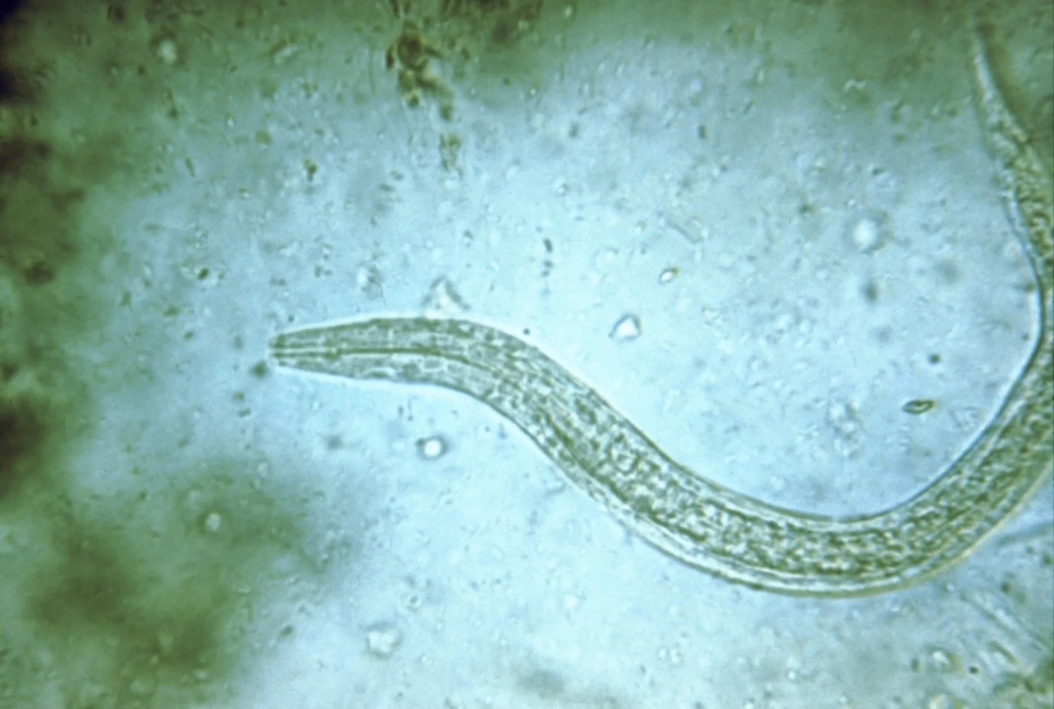 Ngeri, begini bentuk Parasit jika dilihat di bawah mikroskop