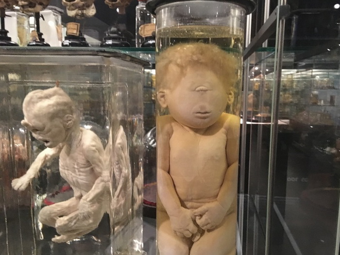 Vrolik, museum di Amsterdam dengan koleksi paling aneh