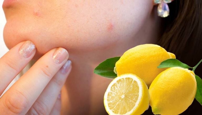 Meski rasanya asam, buah lemon justru bermanfaat bagi kesehatan