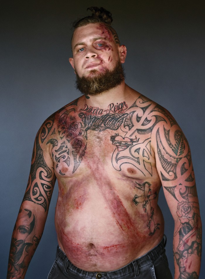 Image Credit : beltedsurvivors.nz