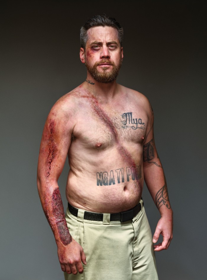 Image Credit : beltedsurvivors.nz