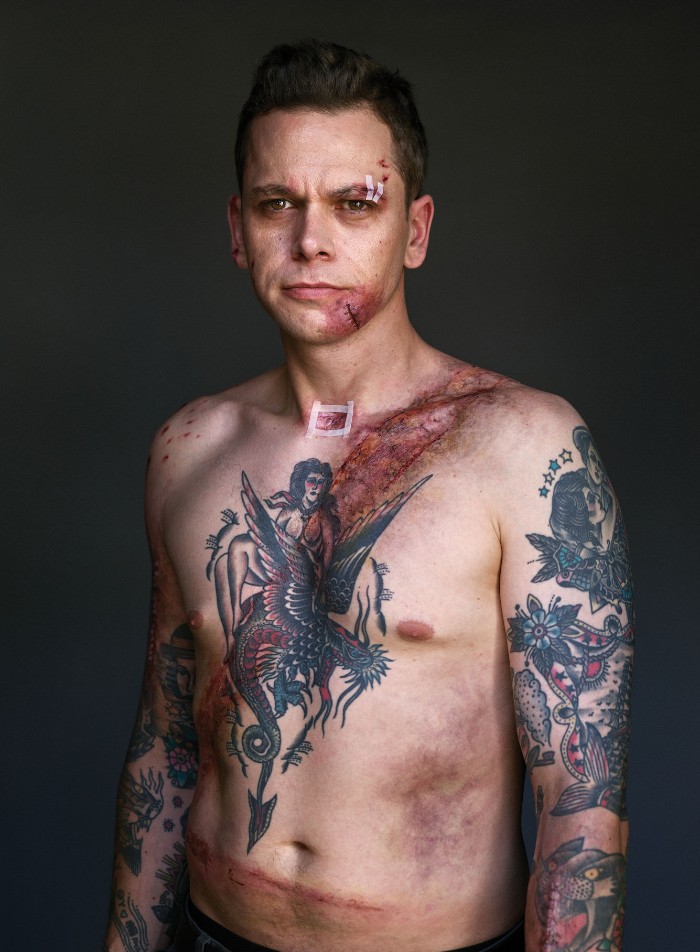Image Credit : beltedsurvivors.nz