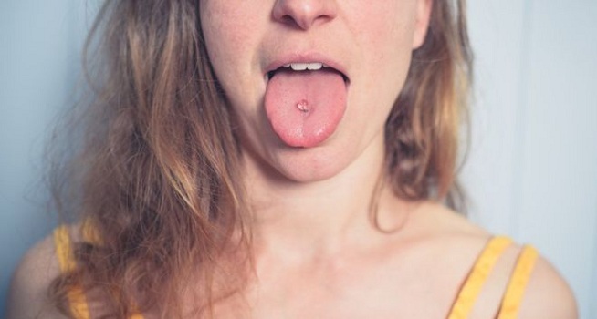Sebelum melakukan oral piercing, ketahui dulu 7 efek sampingnya