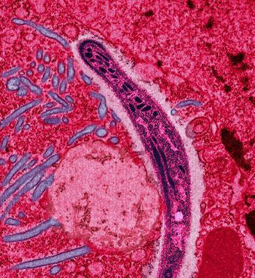 Tangkal malaria dengan 7 tanaman obat tradisional ini