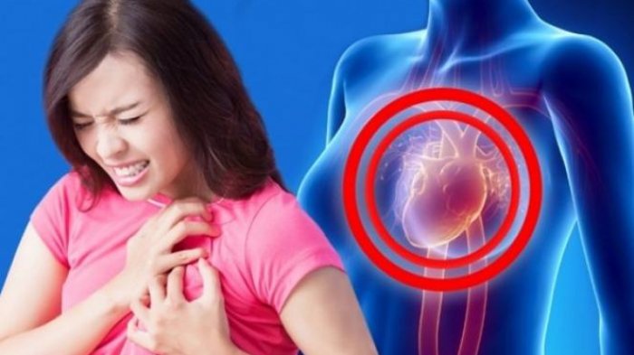 Selalu ingat 4 aturan ini agar terhindar dari penyakit jantung