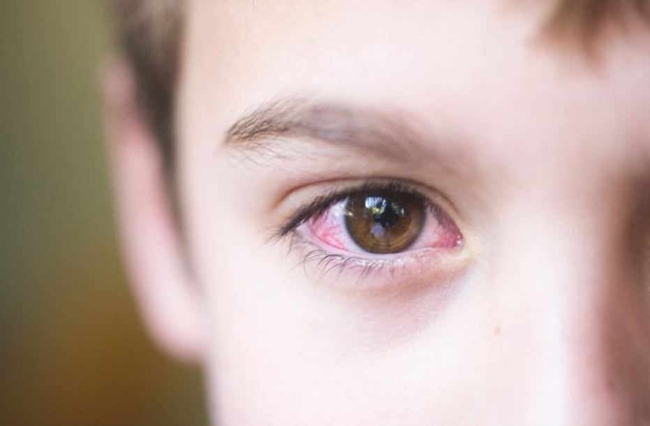 8 Tanda anak memiliki masalah penglihatan yang perlu diperhatikan oleh orangtua
