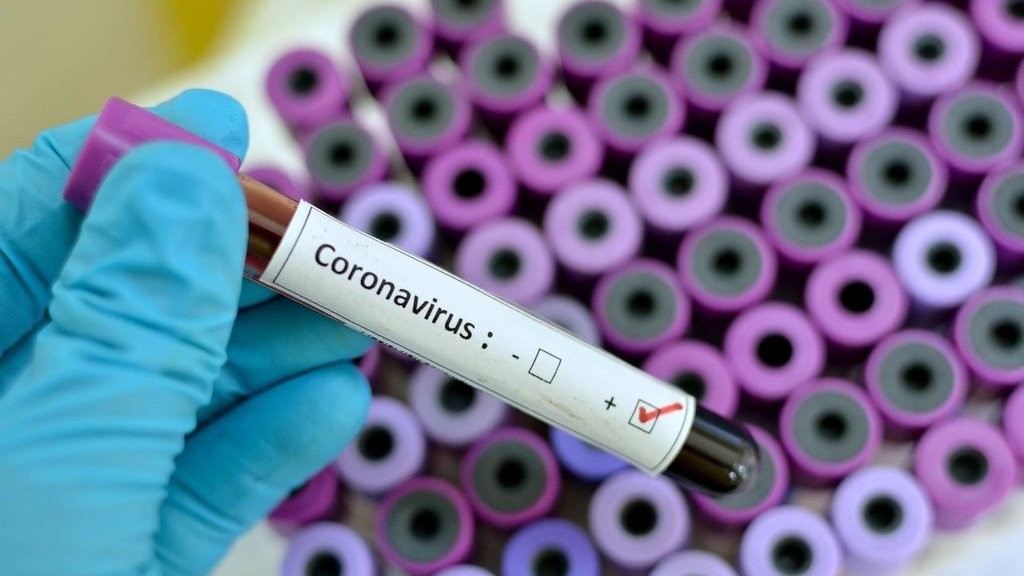 5 Perbedaan COVID-19 dan flu yang perlu kamu ketahui