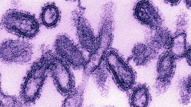 Selain Corona, 7 virus ini juga dianggap paling mematikan di dunia