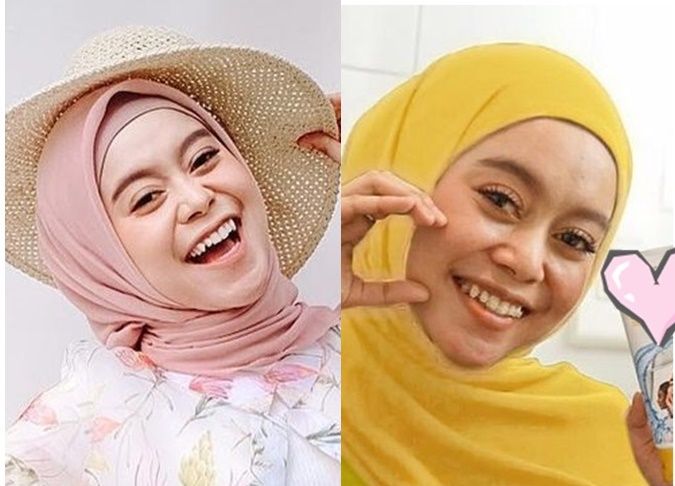 7 Potret senyum manis Lesty Kejora sebelum & sesudah pakai kawat gigi