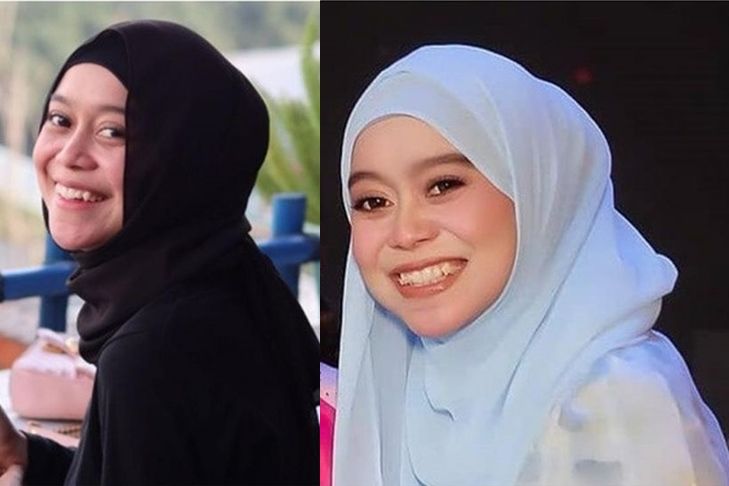 7 Potret senyum manis Lesty Kejora sebelum & sesudah pakai kawat gigi
