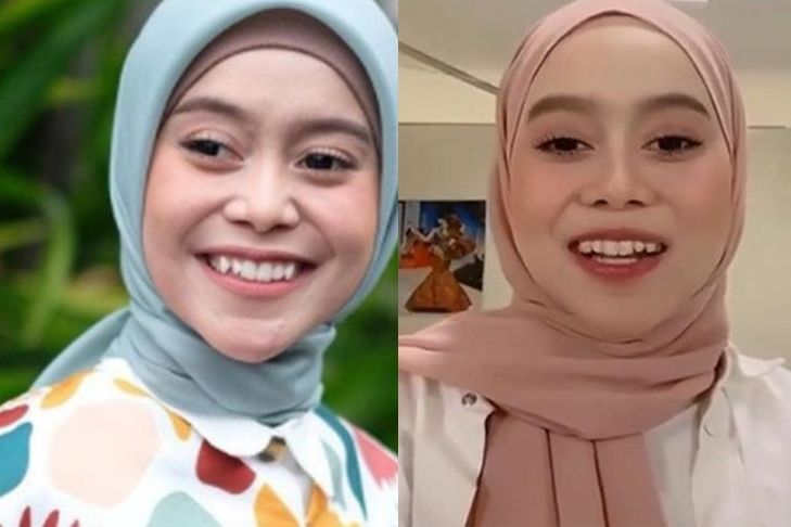 7 Potret senyum manis Lesty Kejora sebelum & sesudah pakai kawat gigi