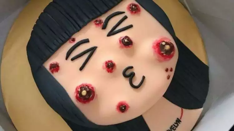 Kue ini berikan sensasi seakan mencet jerawat di wajah, mau cobain?