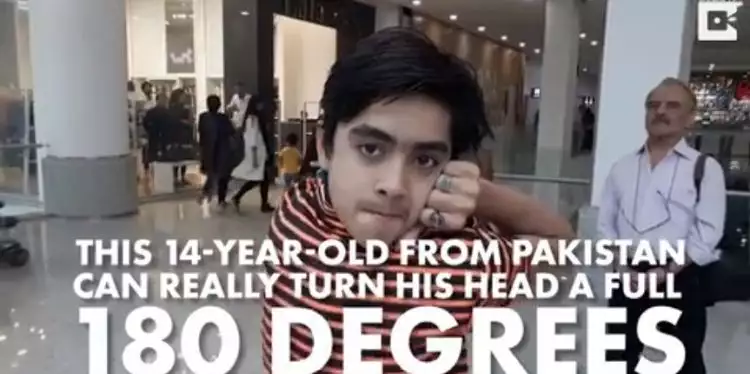 Sameer Khan, anak 14 tahun yang bisa putar kepalanya 180 derajat