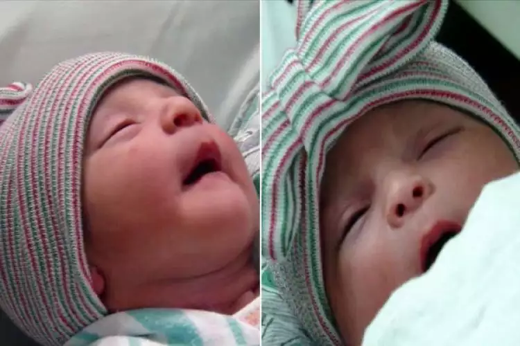 Unik, bayi kembar ini lahir di tahun yang berbeda