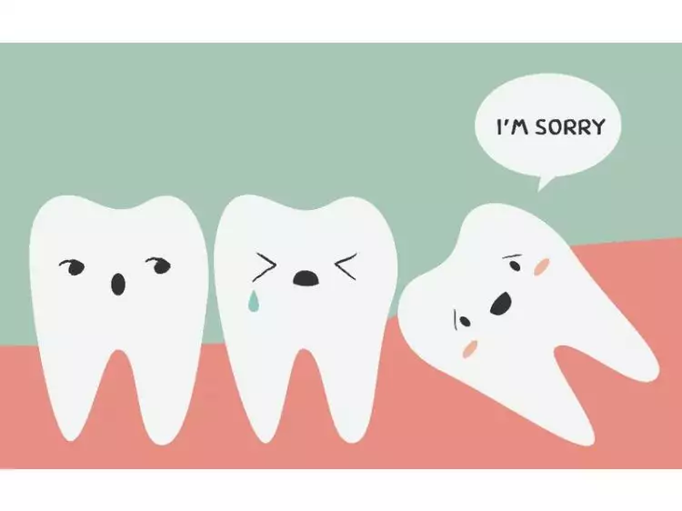 Sakitnya gigi yang terpendam, bagaimana mengatasinya?