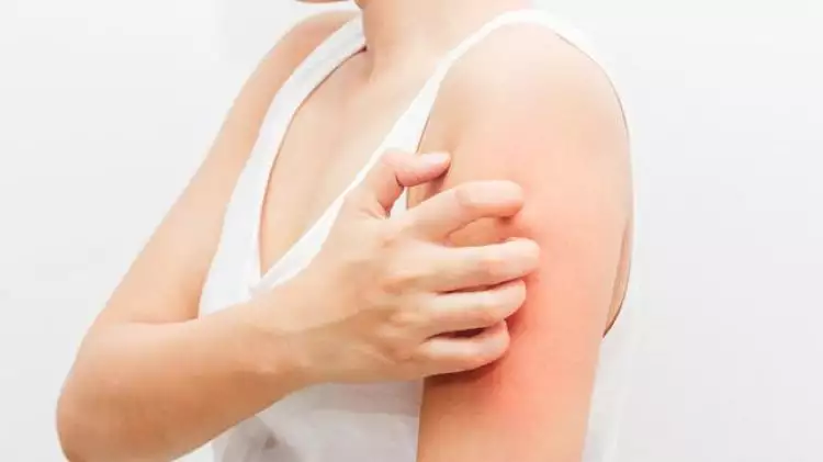 4 Penyakit kulit ini umum terjadi akibat infeksi bakteri