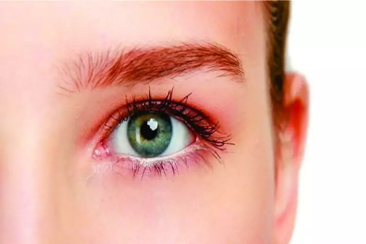 4 Cara mengatasi mata kering secara efektif