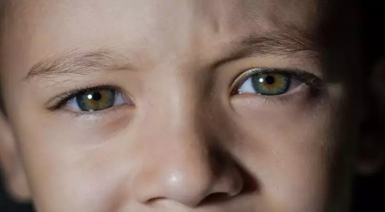 8 Tanda anak punya masalah penglihatan, perlu diperhatikan orang tua