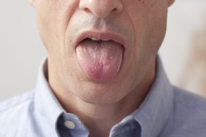 Kenali kesehatanmu lewat warna lidah 