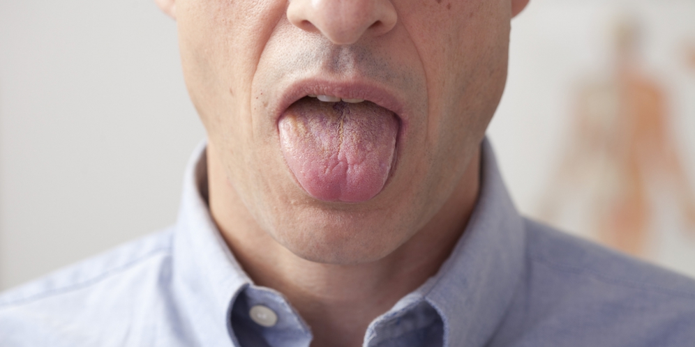 Kenali kesehatanmu lewat warna lidah 