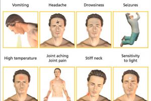 Ini jenis-jenis penyakit meningitis yang perlu kamu tahu