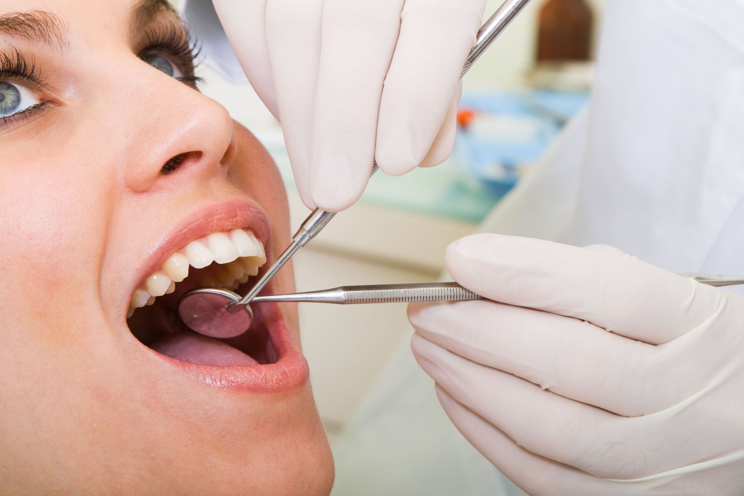4 Penyakit yang bisa dideteksi melalui kondisi gigi