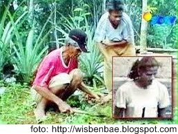 Kisah WNI yang berkelamin ganda Kisah WNI yang berkelamin ganda