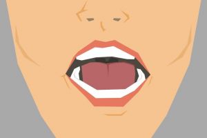 Gusi kamu tiba-tiba berdarah? Ini 5 cara jitu mengatasinya