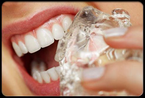 5 kebiasaan ini ternyata membahayakan gigimu, hati-hati!