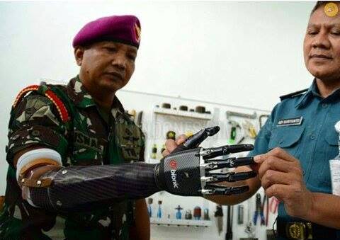 Hilang akibat granat, tangan anggota TNI AL kini 'utuh' lagi