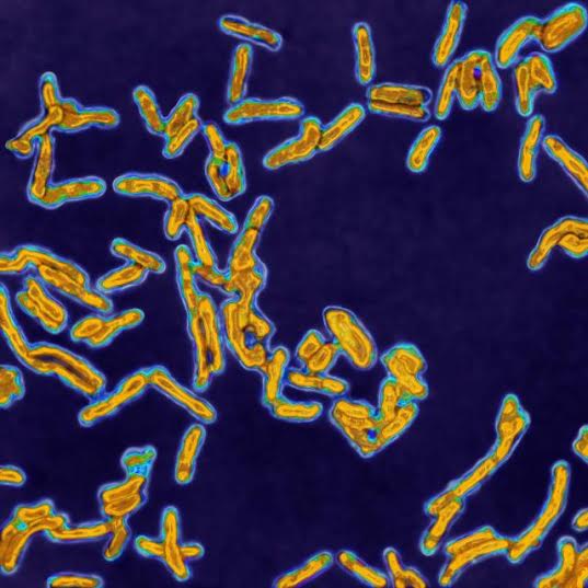 5 Jenis bakteri ini hidup di kulit kamu