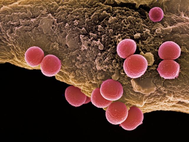 5 Jenis bakteri ini hidup di kulit kamu