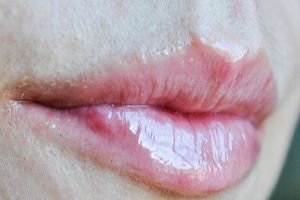 Pengen bibir seksi kayak Kylie Jenner? Kamu cuma perlu kayu manis