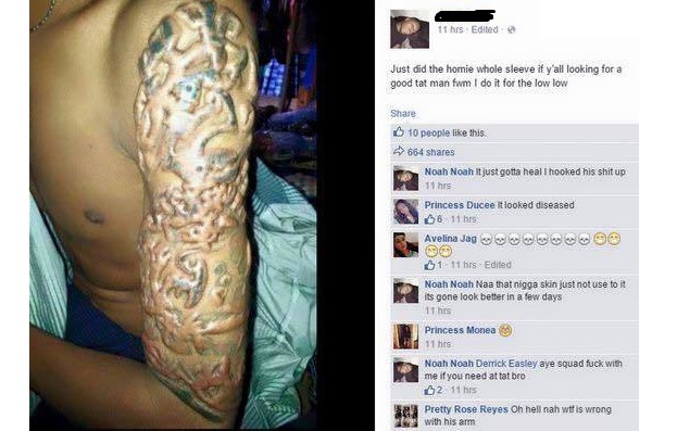 Ingin tampak keren dengan tato, lengan pria ini malah melepuh