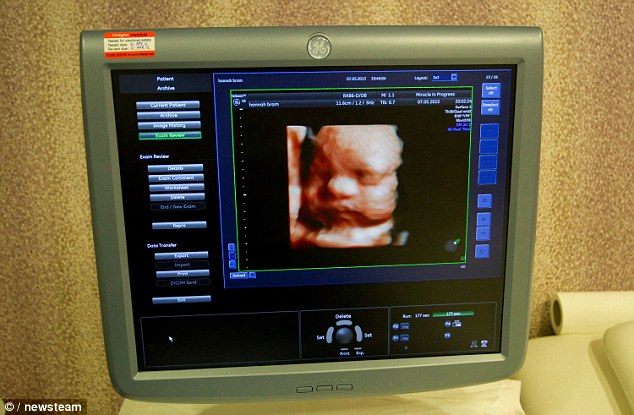 Wolfprint 3D memungkinkan orangtua melihat wajah bayi dalam kandungan