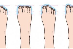 Kepribadian kamu ternyata juga bisa dicermati dari bentuk kaki