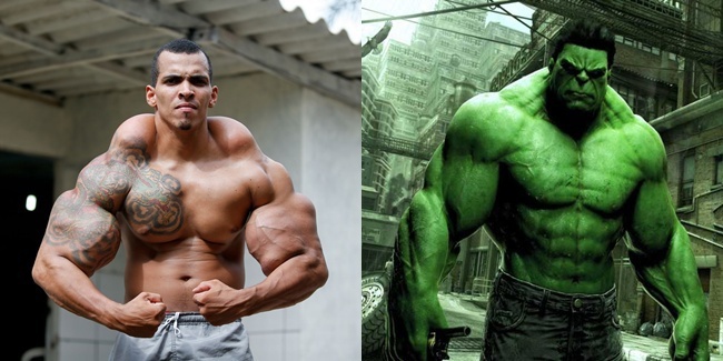 5 Pria ini lakukan operasi plastik demi mirip tokoh idola 5 Pria ini lakukan operasi plastik demi mirip tokoh idola