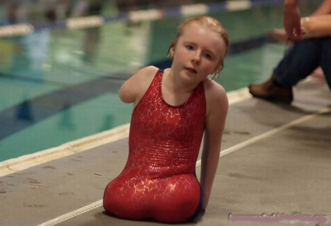 17 Foto buat kamu yang suka galau dan tidak mensyukuri hidup