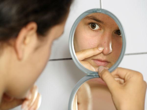 Ini 6 efek samping dari penggunaan lotion kulit, perhatikan ya ladies!