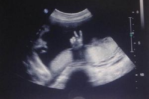 VIDEO: Aksi menakjubkan bayi dalam kandungan, bantu ibunya bernyanyi!