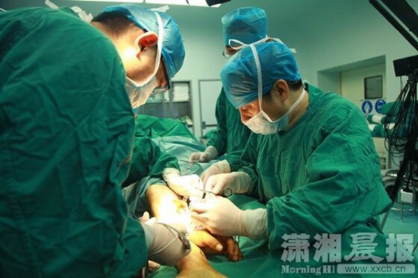 Dokter ini berhasil menyambung tangan pasiennya yang putus, hebat!