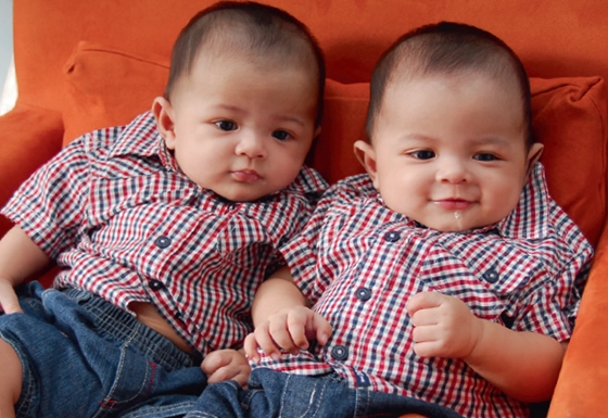 10 Hal yang hanya bisa dilakukan orang kembar